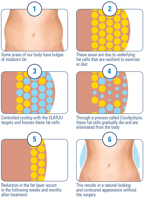 clatuu-how-it-works